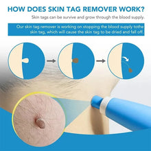 Load image into Gallery viewer, Skin Tag Removal Kit