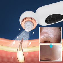 Load image into Gallery viewer, HexoSkin™ Hydrodermabrasion Blackhead Remover