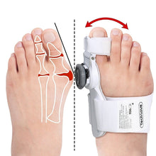 Load image into Gallery viewer, Upgraded Bunion Corrector - 3D Knob Toe Corrector