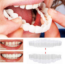 Load image into Gallery viewer, Smile Veneer (Upper & Lower Included)