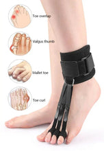 Load image into Gallery viewer, HexoFoot™ Toe Correction Splint