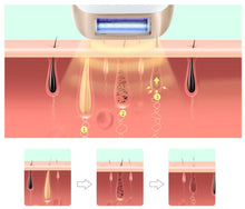 Load image into Gallery viewer, HexoSkin™ IPL Laser Hair Removal Device
