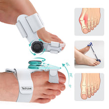 Load image into Gallery viewer, Upgraded Bunion Corrector - 3D Knob Toe Corrector