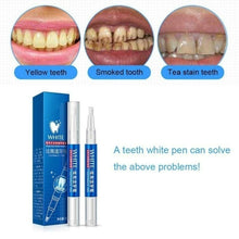 Load image into Gallery viewer, Magic Natural Tooth Whitening Gel Pen