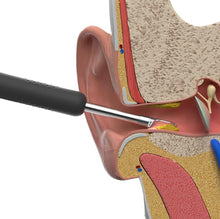 Load image into Gallery viewer, Bebird™ Intelligent Earwax Removal Otoscope