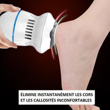 Load image into Gallery viewer, Anti-callus sander