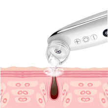 Load image into Gallery viewer, HexoSkin™ Visual Blackhead Remover with HD Camera