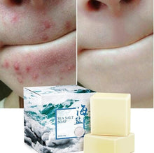 Load image into Gallery viewer, Sea Salt Soap - Acne Treatment