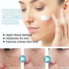 Load image into Gallery viewer, Anti-Dark Spot Skin Care Lightens Pigmentation Spots