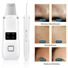 Load image into Gallery viewer, HexoSkin™ Ultrasonic Skin Scrubber
