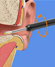 Load image into Gallery viewer, EarBit 3000 - Ear Cleaning Tool With a Camera