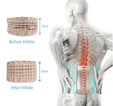 Load image into Gallery viewer, HexoBack™ V2 - Decompression Belt For Back Pain Relief