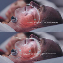 Load image into Gallery viewer, HexoSleep™ Smart Snore Stopper