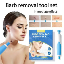 Load image into Gallery viewer, Skin Tag Removal Kit