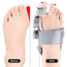 Load image into Gallery viewer, Natural Bunions Corrector Toe Spacer