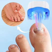 Load image into Gallery viewer, Nail Fungus Cleaning Laser Device