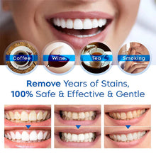 Load image into Gallery viewer, Teeth Whitening Essence Pen