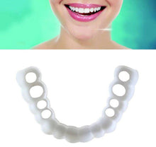 Load image into Gallery viewer, Facial Tooth Cover Retainer