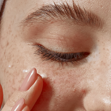 Load image into Gallery viewer, Eye Milia Removal Cream