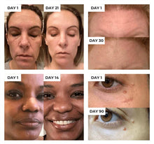 Load image into Gallery viewer, HexoSkin™ Anti-Aging Skincare Wand