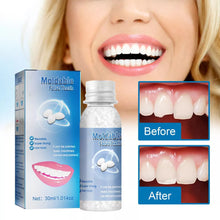 Load image into Gallery viewer, Original Moldable False Teeth