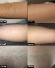 Load image into Gallery viewer, Permanent laser hair removal