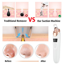 Load image into Gallery viewer, HexoClear™ Vacuum Blackhead Remover
