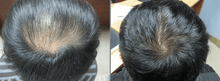 Load image into Gallery viewer, Anti Hair Loss Growth Serum
