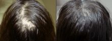 Load image into Gallery viewer, Anti Hair Loss Growth Serum
