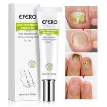 Load image into Gallery viewer, Nail Repair Treatment Gel
