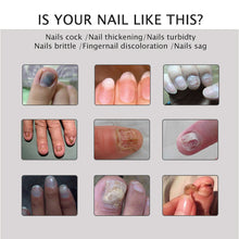 Load image into Gallery viewer, Nail Repair Treatment Gel
