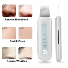 Load image into Gallery viewer, HexoSkin™ Ultrasonic Deep Clean Skin Scrubber
