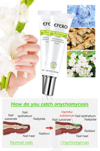 Load image into Gallery viewer, Nail Repair Treatment Gel
