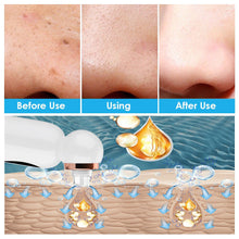 Load image into Gallery viewer, HexoSkin™ Hydrodermabrasion Blackhead Remover
