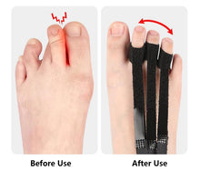 Load image into Gallery viewer, HexoFoot™ Toe Correction Splint
