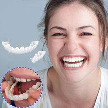 Load image into Gallery viewer, Smile Veneer (Upper &amp; Lower Included)
