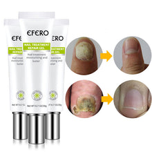 Load image into Gallery viewer, Nail Repair Treatment Gel
