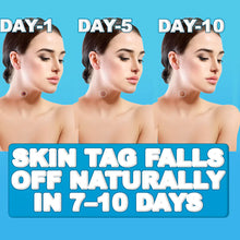 Load image into Gallery viewer, Painless Skin Tag Remover
