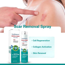 Load image into Gallery viewer, Advanced Scar Spray For All Types of Scars
