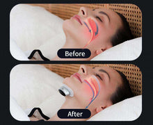 Load image into Gallery viewer, HexoSleep™ Smart Sleep Apnea Aid
