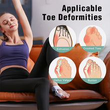Load image into Gallery viewer, Upgraded Bunion Corrector - 3D Knob Toe Corrector
