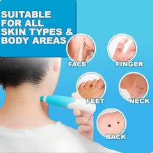 Load image into Gallery viewer, Painless Skin Tag Remover
