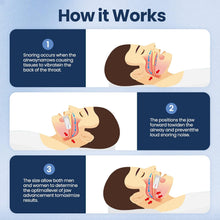 Load image into Gallery viewer, Anti-Snoring Mouthpiece Guard for Sleep Apnea
