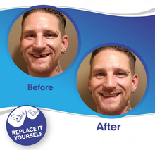Load image into Gallery viewer, Smile Veneer (Upper &amp; Lower Included)
