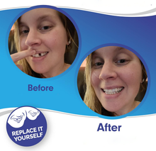 Load image into Gallery viewer, Smile Veneer (Upper &amp; Lower Included)

