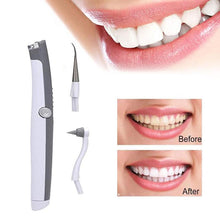 Load image into Gallery viewer, HexoTeeth™ - Electric Sonic Tooth Stain &amp; Plaque Remover

