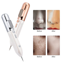 Load image into Gallery viewer, HexoPen™️ Mole &amp; Skin Tag Removal Plasma Pen
