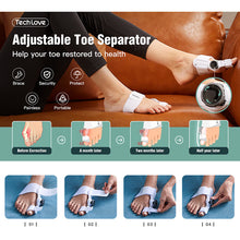 Load image into Gallery viewer, Upgraded Bunion Corrector - 3D Knob Toe Corrector
