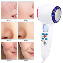 Load image into Gallery viewer, HexoCryo™ At-Home Facial Cryotherapy Device
