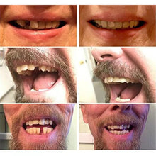 Load image into Gallery viewer, High-Quality False Teeth
